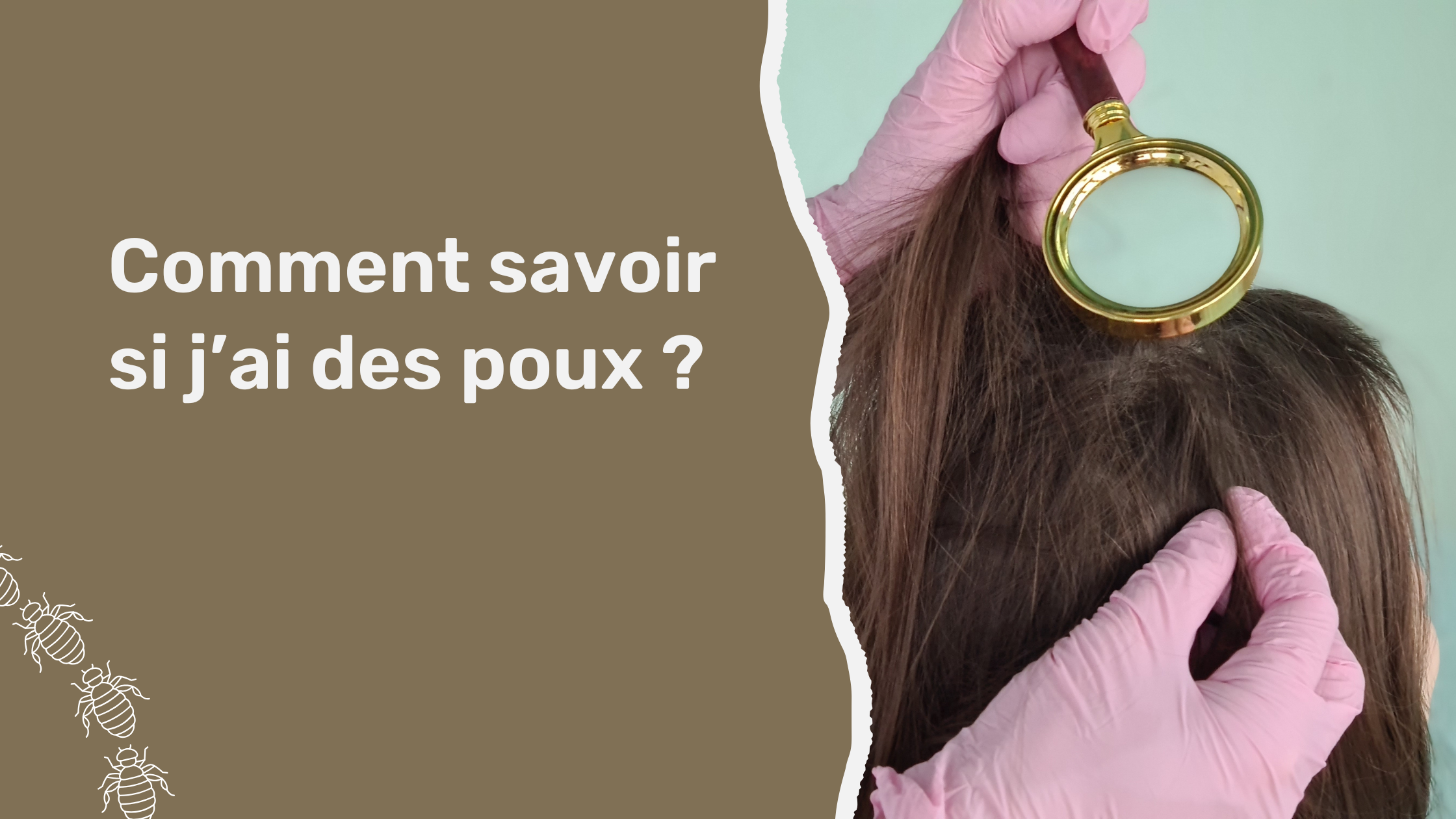 Comment savoir si j’ai des poux ?