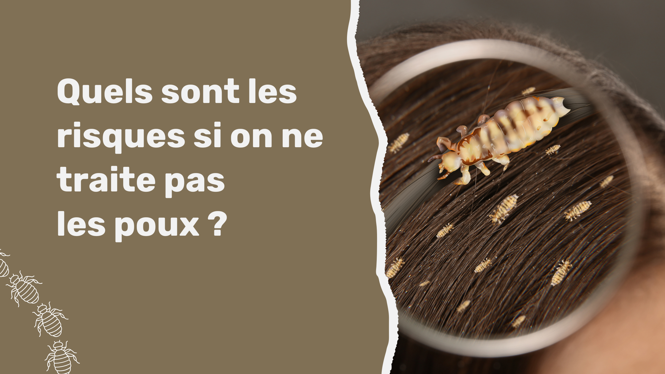 Quels sont les risques si on ne traite pas les poux ?