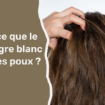 Est-ce que le vinaigre blanc tue les poux ?